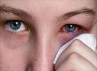 تحقیق شيوع فلج زوج هاي حركتي چشم در افراد دچار ضربه مغزي و ضربه به سر (ترومای چشم)